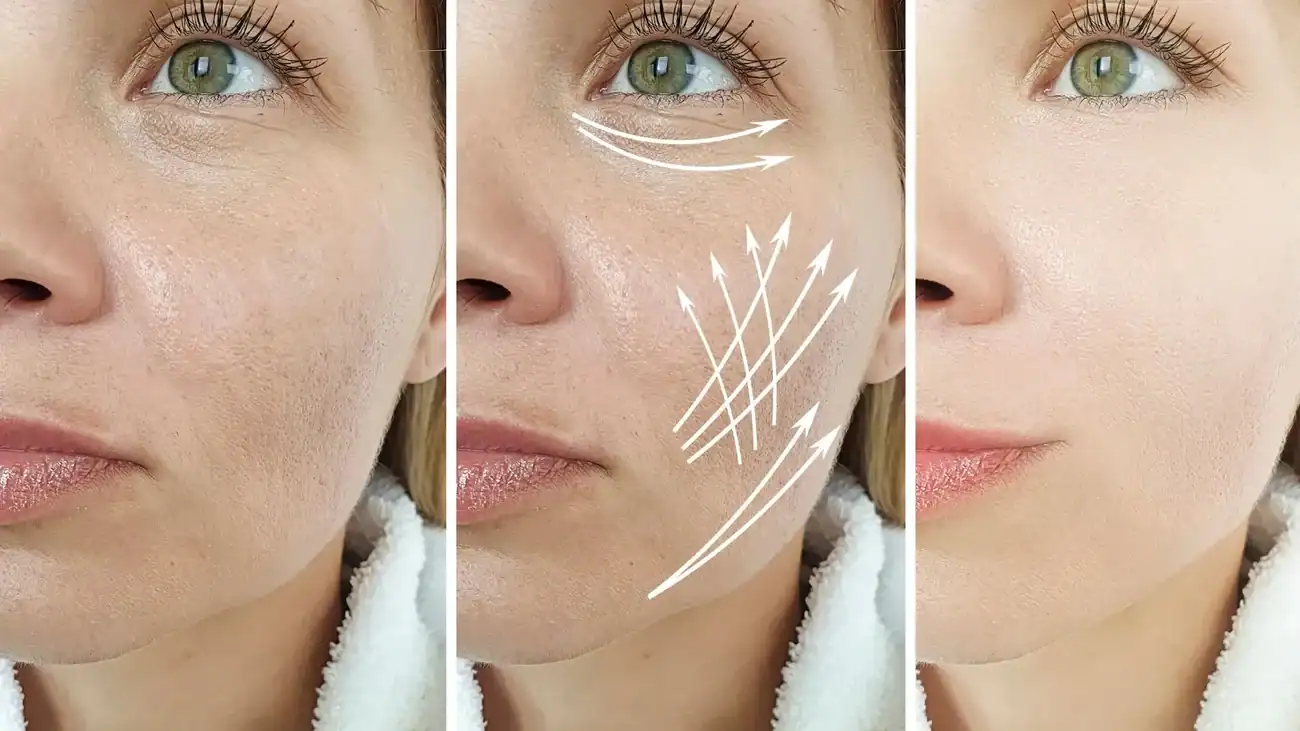Can One Treatment Really Tackle More Than One Skin Concern Nottinghamshire?