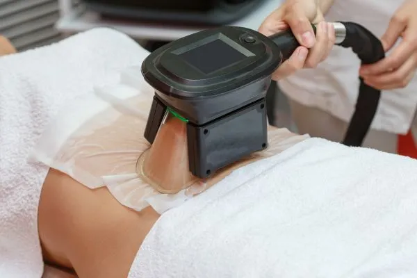 Image of person having fat freezing treatment to help weight gain Nottinghamshire
