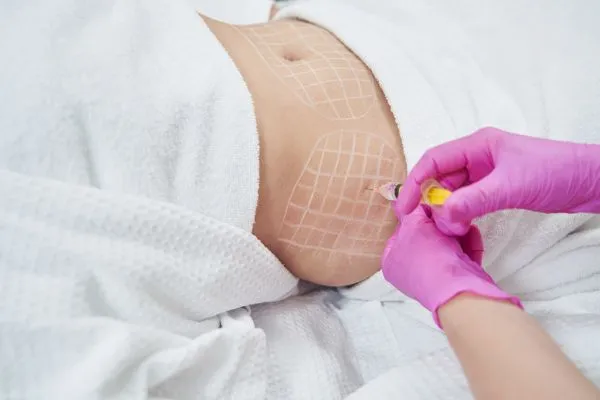 image of fat dissolving injections on love handles to help combat weight gain Nottinghamshire