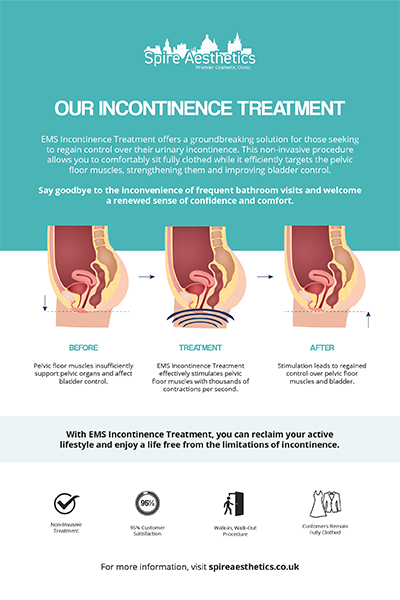 image to show how EMS treatment works for female urinary incontinence Nottinghamshire
