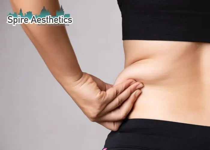 Image of woman pinching fat on their hips Nottinghamshire. Fat Freezing treatment
