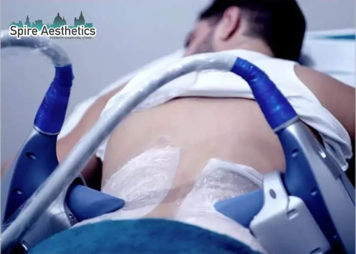 Man having fat freezing treatment done on love handles before a competitions Nottinghamshire to create a sculpted look.