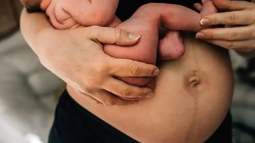 Why Is My Stomach Still Big After Pregnancy Nottinghamshire?